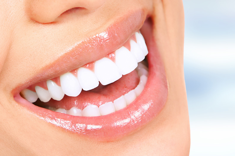 Cosmetic Dentistry in St. Louis